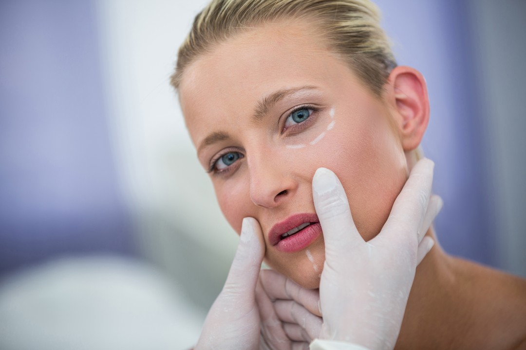Procedimiento avanzado de lifting con hilos mostrando mejora en el contorno facial